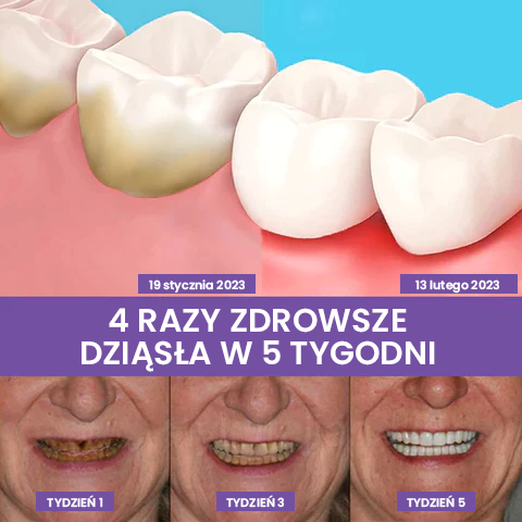 🦷Korektor koloru zębów i serum do pielęgnacji szkliwa