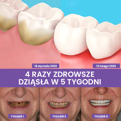 🦷Korektor koloru zębów i serum do pielęgnacji szkliwa